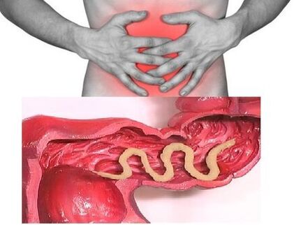 semnele de helmintiază cronică sunt tulburarea dispeptică a intestinului
