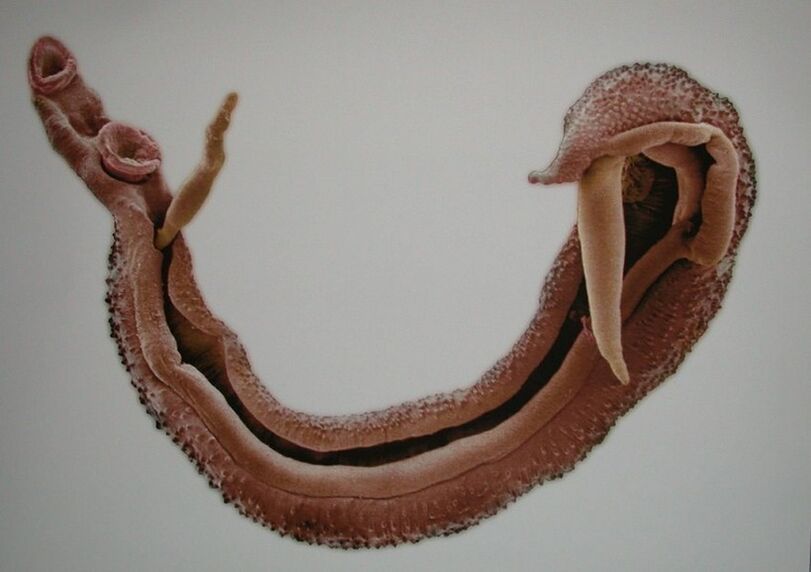 Tipuri de viermi în corpul uman