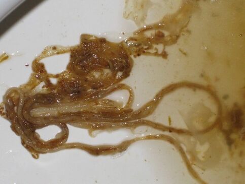 Viermii trăiesc în afara corpului - Viermi și rădăcină de glioblastom unu