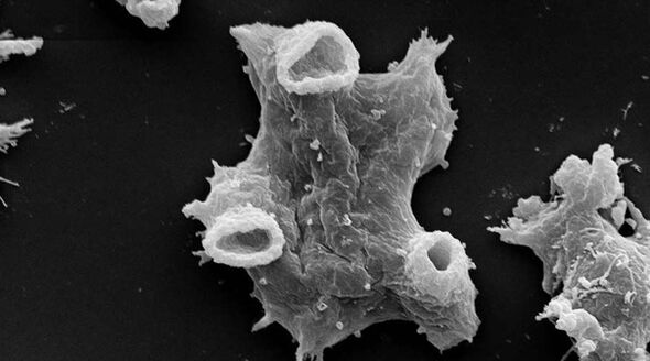 Negleria fowlera este un parazit protozoar periculos pentru viața umană. 